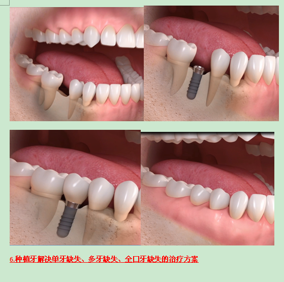 牙科5.png 牙科5.png