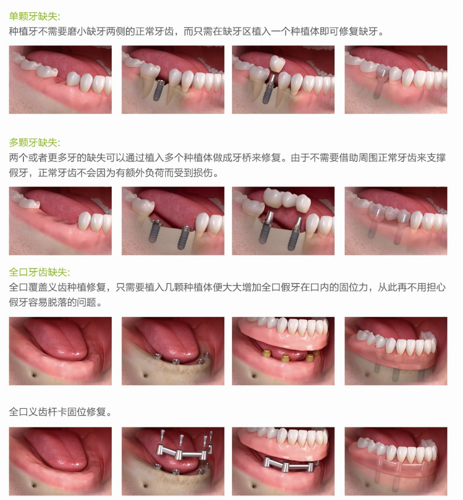 牙科6.png 牙科6.png